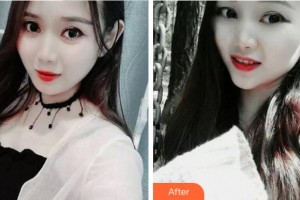 溫州藍(lán)芽口腔門診部楊新新整形價(jià)格表附牙齒隱形矯正案例展示