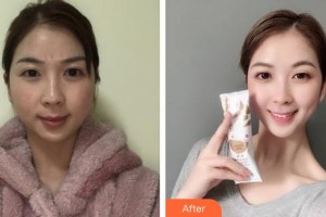 嘉興華山醫(yī)療美容醫(yī)院倪曉云整形價(jià)格表附激光祛斑案例展示