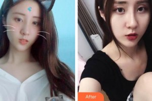 嘉興華山醫(yī)療美容醫(yī)院朱凌賢整形價(jià)格表附激光祛斑案例展示