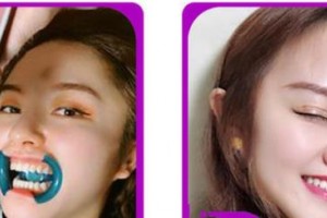 嘉興牙博士口腔門診部郭菲整形價格表附美白劑美白牙齒案例展示