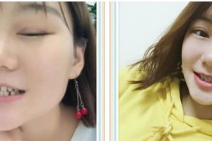 嘉興牙博士口腔門診部馬楠整形價格表附牙齒隱形矯正案例展示