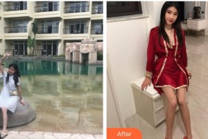 湖州曙光醫(yī)療美容門診部范菁整形價格表附白瓷娃娃案例展示