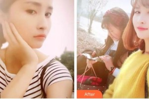 湖州金鉑利口腔門診部增強(qiáng)整形價(jià)格表附美白劑美白牙齒案例展示