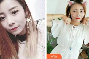 湖州溫馨口腔診所張敏秀整形價(jià)格表附牙齒隱形矯正案例展示