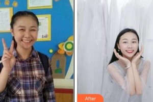 湖州陳景康牙科診所陳景康整形價(jià)格表附金屬托槽矯正案例展示