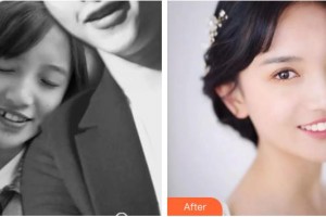 湖州徐兆桂牙科診所徐兆桂整形價(jià)格表附金屬托槽矯正案例展示