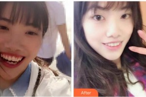 紹興德維口腔醫(yī)院韓志夏整形價格表附牙齒陶瓷矯正案例展示