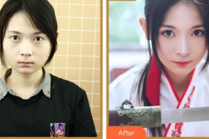 紹興愛(ài)爾眼科醫(yī)院閔宗英整形價(jià)格表附眼部綜合案例展示