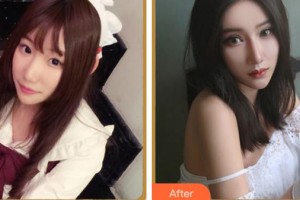 紹興愛(ài)爾眼科醫(yī)院王曉瑛整形價(jià)格表附眼部綜合案例展示