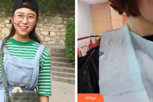 紹興京韓口腔醫(yī)院柳二弼整形價(jià)格表附牙齒陶瓷矯正案例展示