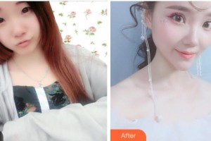 金華康美醫(yī)療美容綜合門診部林子豪整形價(jià)格表附眼部綜合案例展示