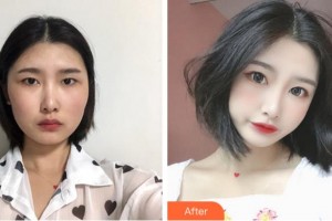 清遠(yuǎn)華美整形外科門診部劉金華整形價(jià)格表附切開雙眼皮案例展示