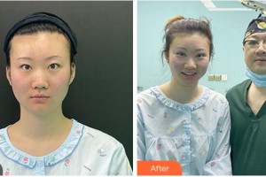 金華芘麗芙（原華美）整形醫(yī)院王敏駿整形價(jià)格表附眼部綜合案例展示