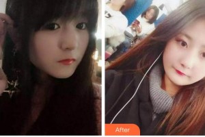 金華周亞軍口腔門診部張政通整形價(jià)格表附根管調(diào)節(jié)案例展示