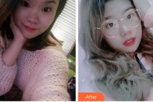 金華周亞軍口腔門診部袁云志整形價(jià)格表附牙齒隱形矯正案例展示