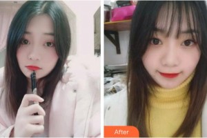 金華口腔醫(yī)院徐美丹整形價(jià)格表附牙齒隱形矯正案例展示