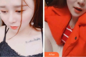 金華口腔醫(yī)院董翔整形價(jià)格表附超聲波潔牙案例展示