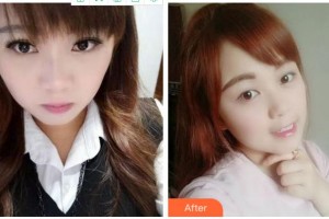 金華周亞軍口腔門診部鄒多宏整形價格表附牙齒隱形矯正案例展示