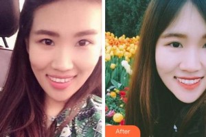 金華周亞軍口腔門診部金志平整形價格表附牙齒隱形矯正案例展示