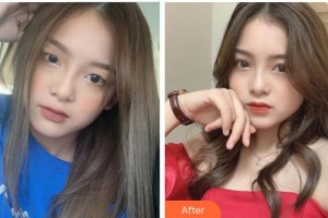 衢州芘麗芙整形美容醫(yī)院趙俊整形價格表附眼部綜合案例展示