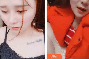 臺(tái)州牙科醫(yī)院齊淑敏整形價(jià)格表附超聲波潔牙案例展示