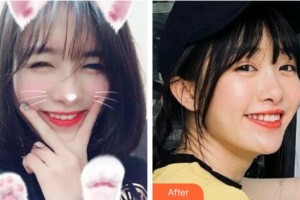 臺州拜博口腔醫(yī)院趙大鵬整形價格表附冷光美白案例展示