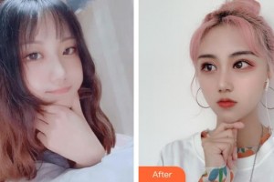 臺州國際眼科醫(yī)院江秋若住院醫(yī)師整形價格表附眼部綜合案例展示