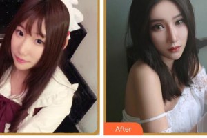 臺州國際眼科醫(yī)院黃春聯(lián)整形價格表附眼部綜合案例展示