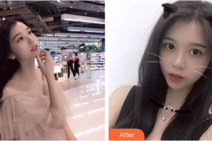 深圳博愛醫(yī)院整形美容中心李微整形價格表附小氣泡案例展示