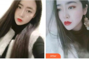 臺(tái)州康貝佳口腔醫(yī)院盛夢(mèng)芽整形價(jià)格表附金屬托槽矯正案例展示