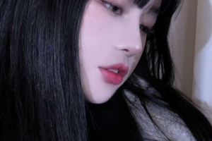 日照白求恩整形美容醫(yī)院許建忠整形價(jià)格表附埋線提升案例展示