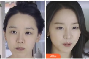 四川西嬋整形美容醫(yī)院黃琪平醫(yī)務(wù)科科長整形價(jià)格表附激光除皺案例展示