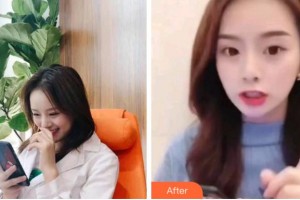 四川大學華西口腔醫(yī)院美容中心黃俊整形價格表附超聲波潔牙案例展示