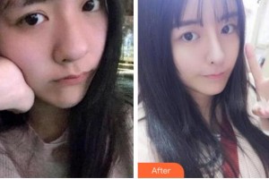 四川華人醫(yī)聯(lián)整形美容醫(yī)院張叔平整形價格表附熱瑪吉案例展示