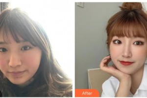 四川西嬋整形美容醫(yī)院許雙婷整形價格表附激光祛斑案例展示