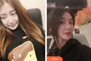 四川圣麗整形美容醫(yī)院李理整形價格表附鼻修復(fù)案例展示