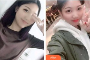 自貢維樂(lè)新橋口腔門診部田玉霞整形價(jià)格表附根管調(diào)節(jié)案例展示