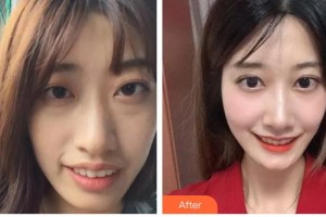 自貢維樂(lè)新橋口腔門診部陳琳整形價(jià)格表附牙齒陶瓷矯正案例展示