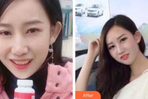 攀枝花奇麗整形美容醫(yī)院李宏整形價(jià)格表附牙齒隱形矯正案例展示