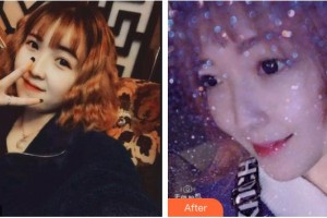 德陽維樂新橋口腔門診部周文書整形價格表附金屬托槽矯正案例展示