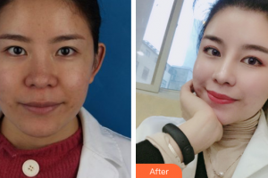 深圳新興皮膚病?？崎T診部周秋根整形價(jià)格表附皮膚管理案例展示