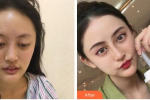 綿陽東美奧拉克醫(yī)療美容門診部黃國強(qiáng)整形價格表附鼻部綜合案例展示