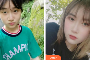 深圳美顏醫(yī)療美容門診部范開防整形價(jià)格表附雙眼皮案例展示