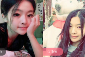 深圳黛顏醫(yī)療美容醫(yī)院馬蘭整形價(jià)格表附女性私密案例展示