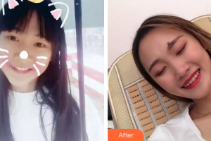 深圳美加美醫(yī)療美容門診部肖文榮整形價(jià)格表附金屬托槽牙齒矯正案例展示