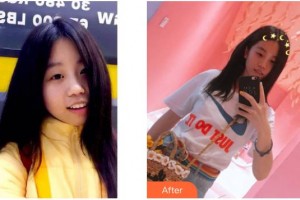 遂寧嘉慧口腔門診部蒲成浩整形價(jià)格表附超聲波潔牙案例展示