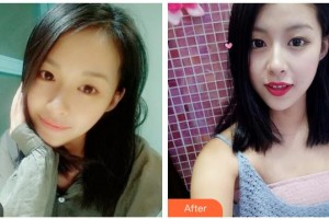 樂(lè)山王玉琨皮膚病專(zhuān)科醫(yī)院張麗整形價(jià)格表附眼部綜合案例展示