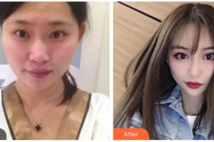 樂(lè)山愛(ài)爾眼科醫(yī)院宋德智整形價(jià)格表附眼部綜合案例展示