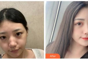 南充韓美整形美容門診部陳慶紅整形價格表附激光祛斑案例展示