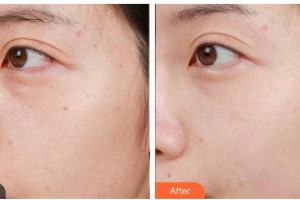 南充嬌美傾城醫(yī)學美容門診部王健整形價格表附激光美膚激光案例展示